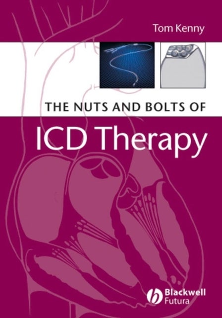 Bilde av The Nuts And Bolts Of Icd Therapy Av Tom (st. Jude Medical Austin Texas) Kenny