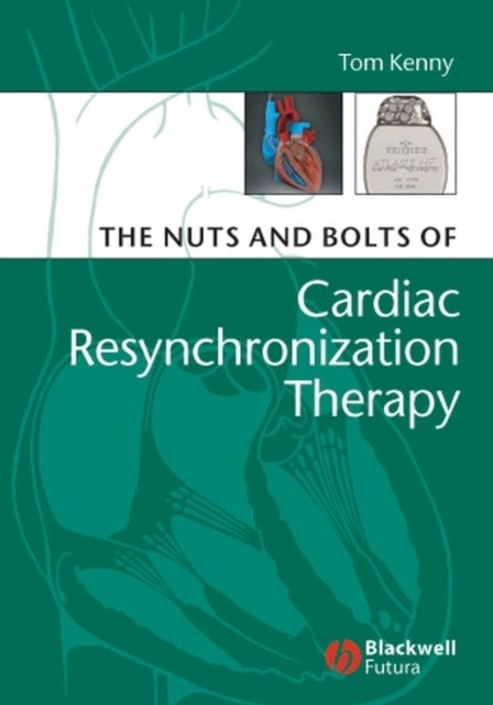 Bilde av The Nuts And Bolts Of Cardiac Resynchronization Therapy Av Tom (st. Jude Medical Austin Texas) Kenny