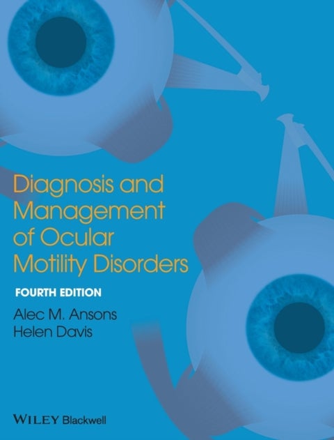 Diagnosis and Management of Ocular Motility Disorders