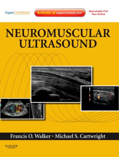 Bilde av Neuromuscular Ultrasound Av Francis (professor Of Neurology Wake Forest University School Of Medicine Winston-salem Nc) Walker, Michael S. (assistant