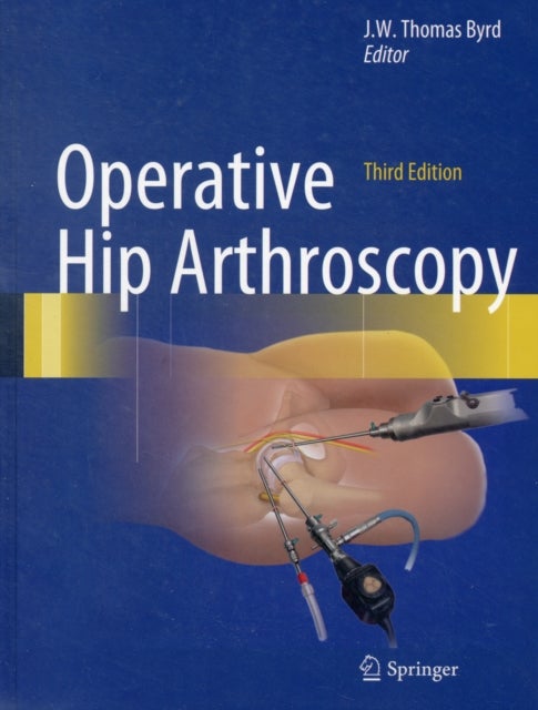 Bilde av Operative Hip Arthroscopy
