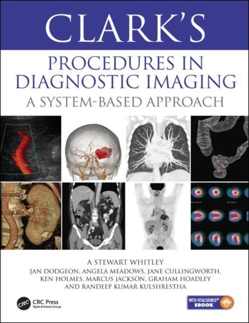Bilde av Clark¿s Procedures In Diagnostic Imaging Av A Stewart (radiology Advisor Uk Radiology Advisory Services And The Director Of Professional Practice For