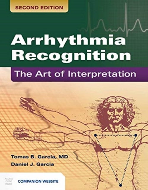 Bilde av Arrhythmia Recognition: The Art Of Interpretation Av Tomas B. Garcia, Daniel J. Garcia