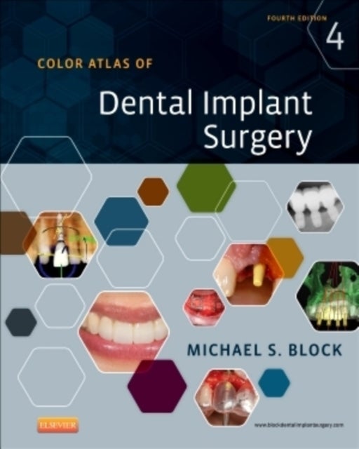 Bilde av Color Atlas Of Dental Implant Surgery Av Michael S. (clinical Professor Department Of Oral And Maxillofacial Surgery School Of Dentistry Louisiana Sta