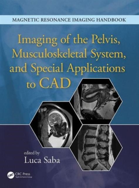 Bilde av Imaging Of The Pelvis, Musculoskeletal System, And Special Applications To Cad