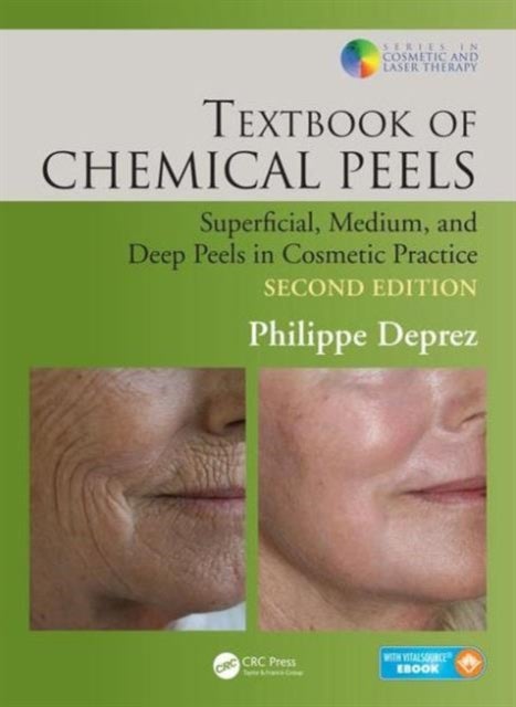 Textbook of Chemical Peels - Superficial, Medium, and Deep Peels in Cosmetic Practice