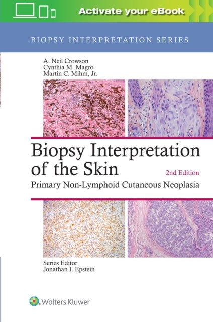 Bilde av Biopsy Interpretation Of The Skin Av A. Neil Crowson, Cynthia M. Magro