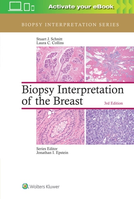 Bilde av Biopsy Interpretation Of The Breast Av Stuart J. Schnitt, Laura C. Collins