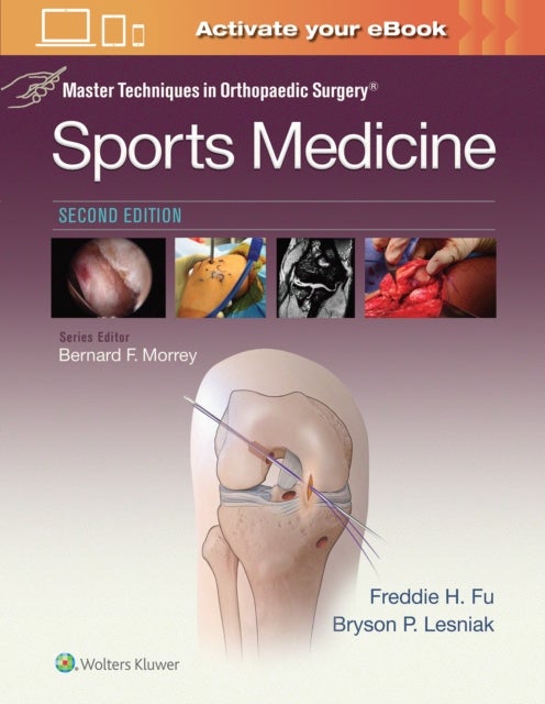 Bilde av Master Techniques In Orthopaedic Surgery: Sports Medicine Av Freddie H. M.d. Fu