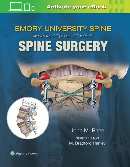 Bilde av Emory&#039;s Illustrated Tips And Tricks In Spine Surgery