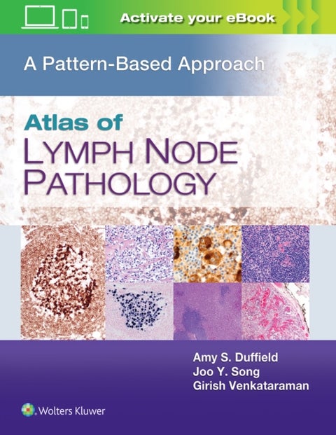 Atlas of Lymph Node Pathology - A Pattern Based Approach