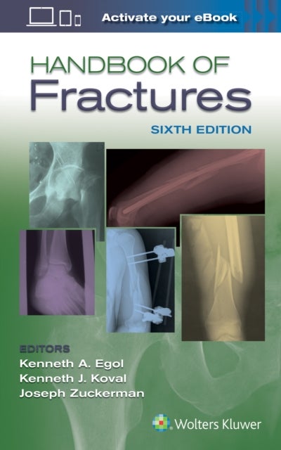 Bilde av Handbook Of Fractures