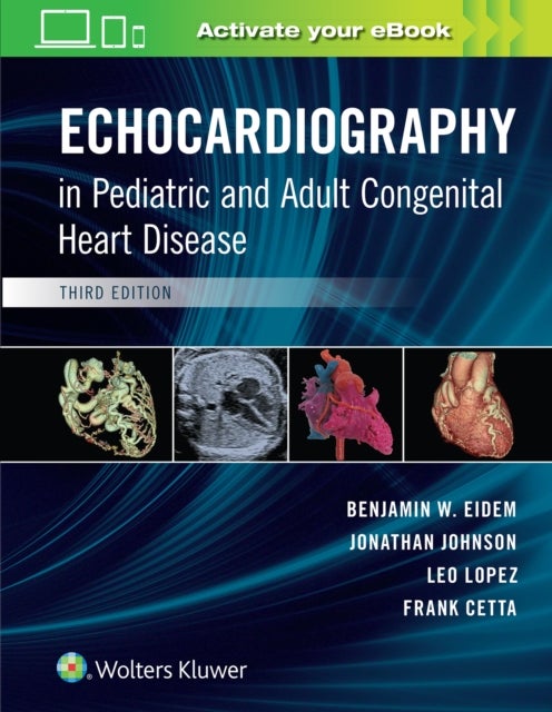 Bilde av Echocardiography In Pediatric And Adult Congenital Heart Disease