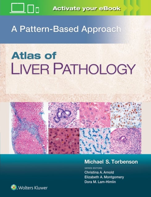 Bilde av Atlas Of Liver Pathology: A Pattern-based Approach Av Michael Md Torbenson