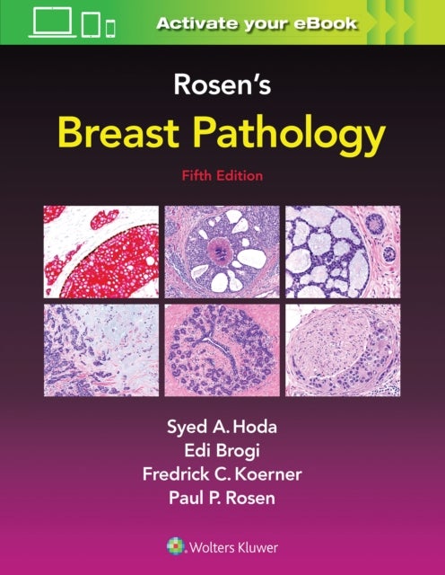 Bilde av Rosen&#039;s Breast Pathology Av Syed A. Hoda, Paul Peter Md Rosen, Edi Brogi, Frederick C. Koerner