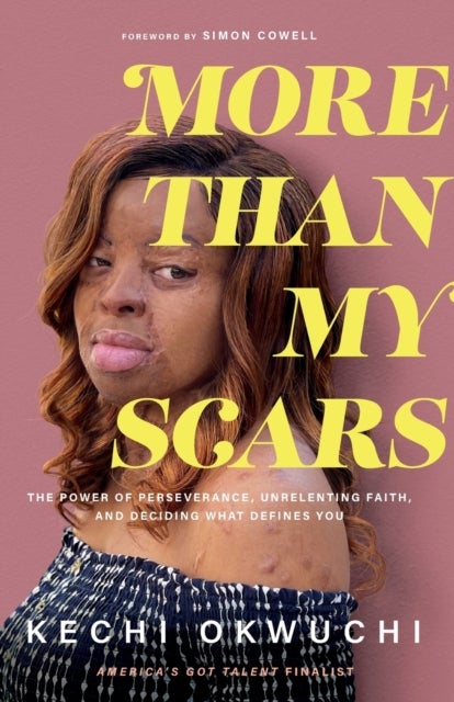 Bilde av More Than My Scars - The Power Of Perseverance, Unrelenting Faith, And Deciding What Defines You Av Kechi Okwuchi, Simon Cowell