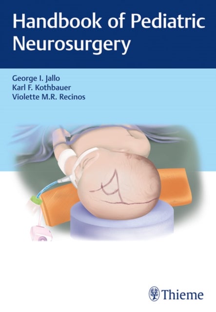 Bilde av Handbook Of Pediatric Neurosurgery