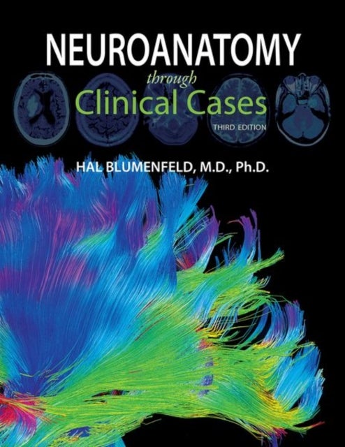 Bilde av Neuroanatomy Through Clinical Cases Av Hal (professor Departments Of Neurology Neuroscience And Neurosurgery Professor Departments Of Neurology Neuros
