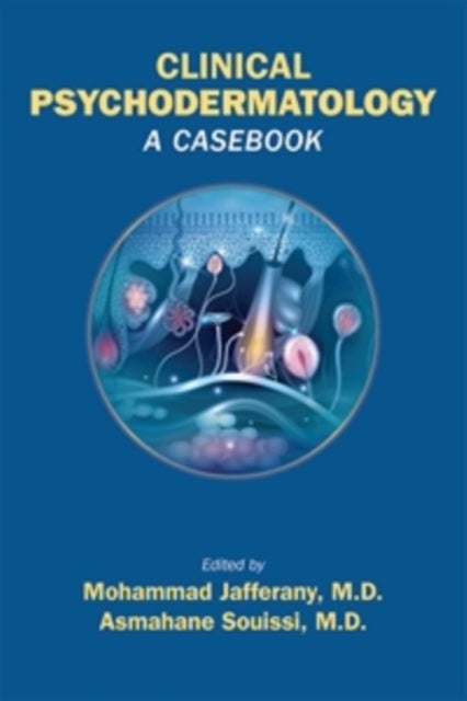 Clinical Psychodermatology - A Casebook