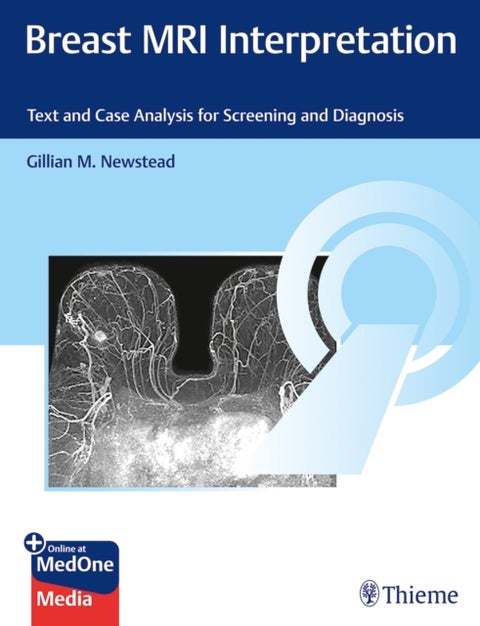 Breast MRI Interpretation - Text and Case Analysis for Screening and Diagnosis