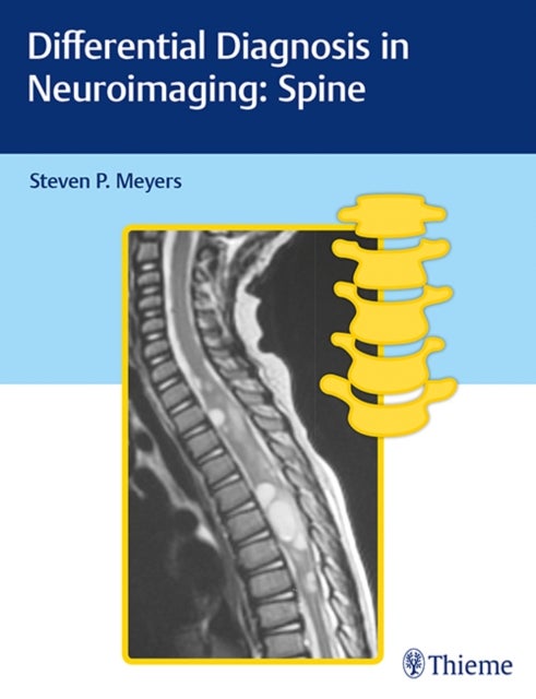 Bilde av Differential Diagnosis In Neuroimaging: Spine