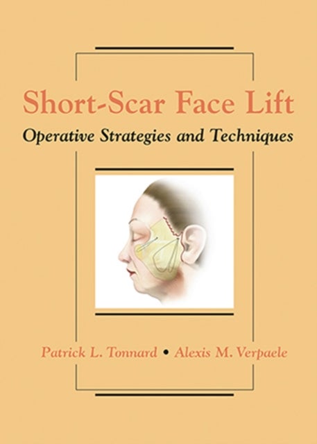 Short-Scar Face Lift - Operative Strategies and Techniques