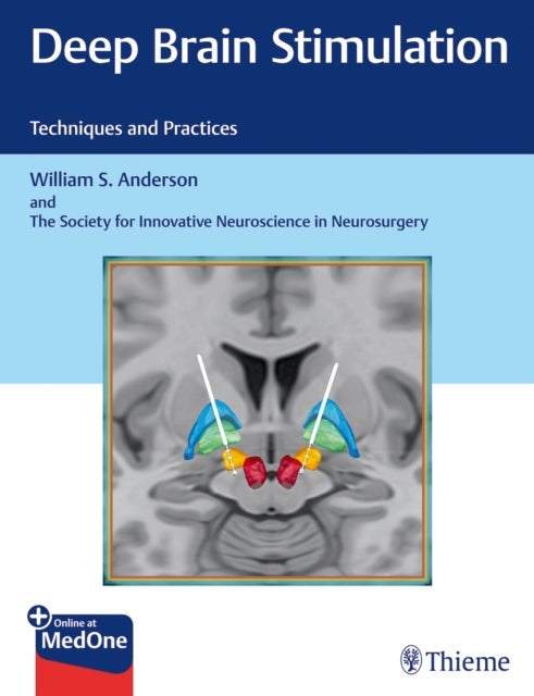 Deep Brain Stimulation - Techniques and Practices