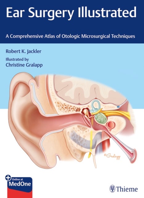Ear Surgery Illustrated - A Comprehensive Atlas of Otologic Microsurgical Techniques