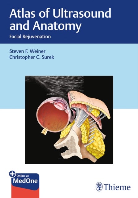 Atlas of Ultrasound and Anatomy - Facial Rejuvenation