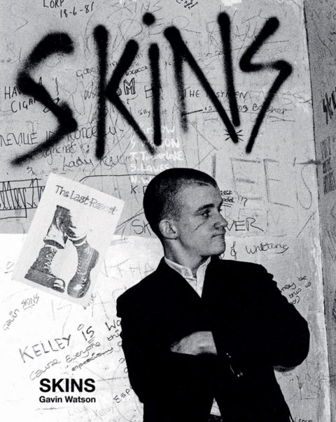 Skins - Gavin Watson