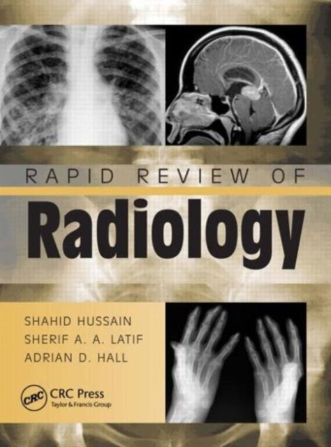 Bilde av Rapid Review Of Radiology Av Shahid (heart Of England Nhs Foundation Trust Heartlands Hospital Birmingham Uk) Hussain, Sherif Aaron Abdel Mrcs Latif,