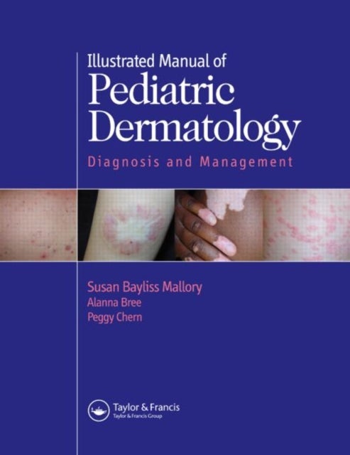 Bilde av Illustrated Manual Of Pediatric Dermatology Av Susan Mallory, Alanna F. (st. Louis Missouri Usa) Bree, Peggy (st. Louis Missouri Usa) Chern