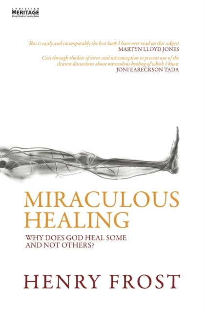 Miraculous Healing - Why does God heal some and not others?