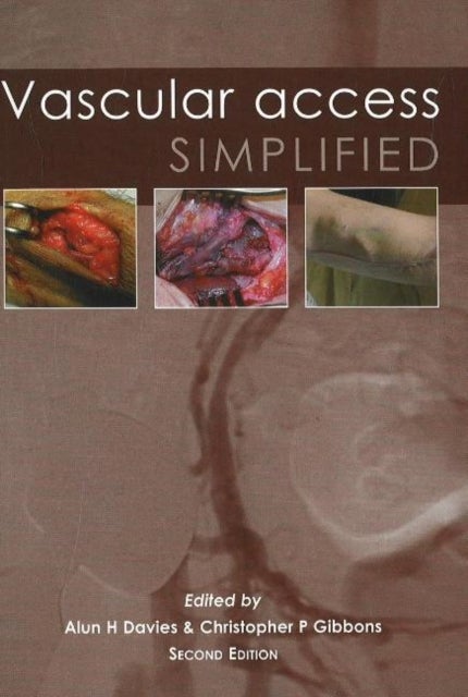 Vascular Access Simplified