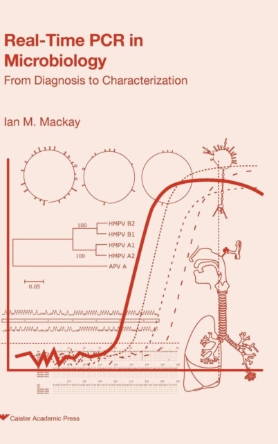 Real-time PCR in Microbiology - From Diagnosis to Characterization