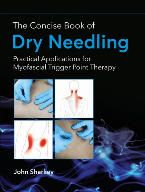The Concise Book of Dry Needling - Practical Applications for Myofascial Trigger Point Therapy
