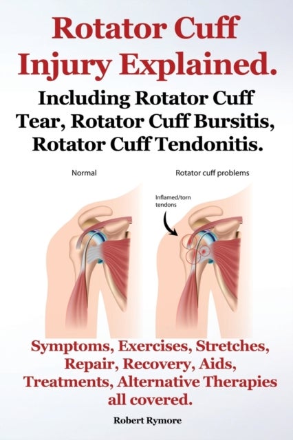 Rotator Cuff Injury Explained. Including Rotator Cuff Tear, Rotator Cuff Bursitis, Rotator Cuff Tend