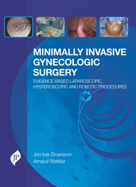 Minimally Invasive Gynecologic Surgery: Evidence-Based Laparoscopic, Hysteroscopic & Robotic Surgeri