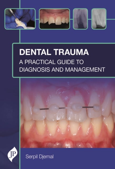 Dental Trauma - A Practical Guide to Diagnosis and Management