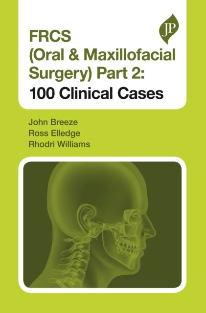 Bilde av Frcs (oral &amp; Maxillofacial Surgery) Part 2: 100 Clinical Cases Av John Breeze, Ross Elledge, Rhodri Williams