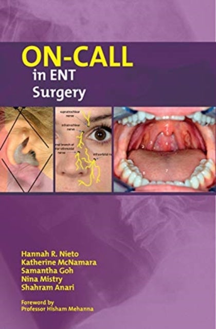 Bilde av On-call In Ent Surgery Av Hannah Nieto, Katherine Mcnamara, Samantha Goh, Nina Mistry, Shahram Anari