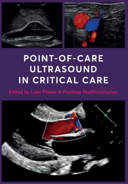 Bilde av Point-of-care Ultrasound In Critical Care