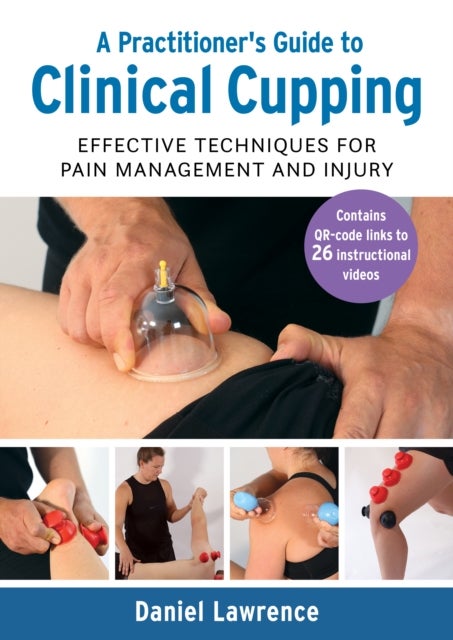 A Practitioner's Guide to Clinical Cupping - Effective Techniques for Pain Management and Injury