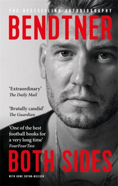 Bendtner: Both Sides