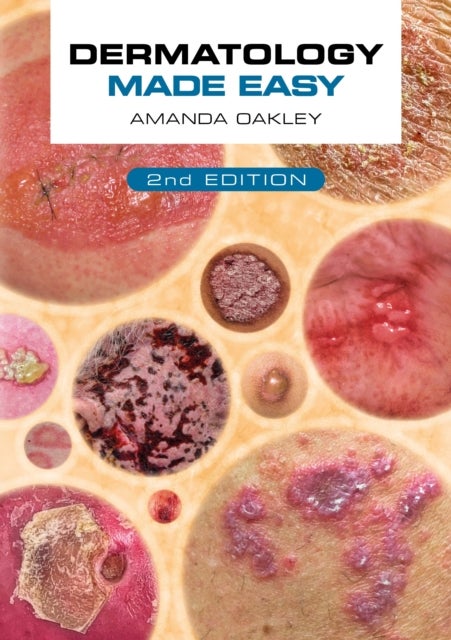 Bilde av Dermatology Made Easy, Second Edition Av Amanda (adjunct Associate Professor Department Of Medicine University Of Auckland New Zealand) Oakley