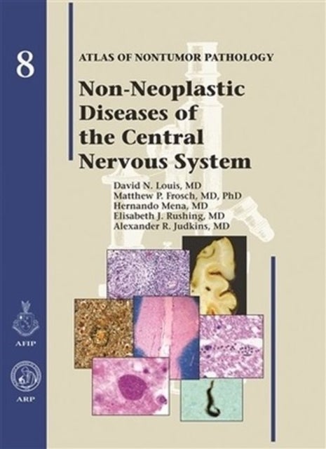 Bilde av Non-neoplastic Diseases Of The Central Nervous System Av David N. Louis, Matthew P. Frosch, Hernando Mena, Elisabeth J. Rushing, Alexander R. Judkins