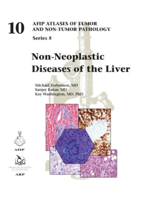 Bilde av Non-neoplastic Diseases Of The Liver Av Michael Md Torbenson, Sanjay Kakar, Kay Washington