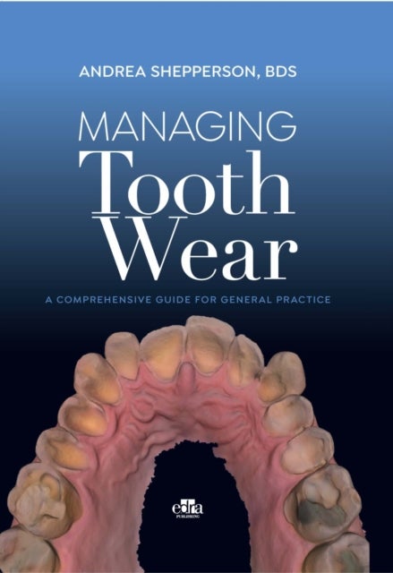 Bilde av Managing Tooth Wear Av Andrea Shepperson