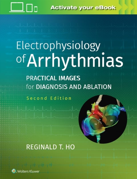 Electrophysiology of Arrhythmias - Practical Images for Diagnosis and Ablation