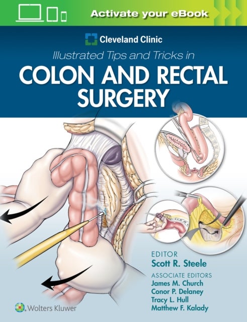 Bilde av Cleveland Clinic Illustrated Tips And Tricks In Colon And Rectal Surgery Av Scott Steele